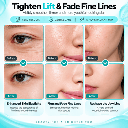 7-Color LED Facial Sculpting Massager – 3-Level Suction Beauty Device